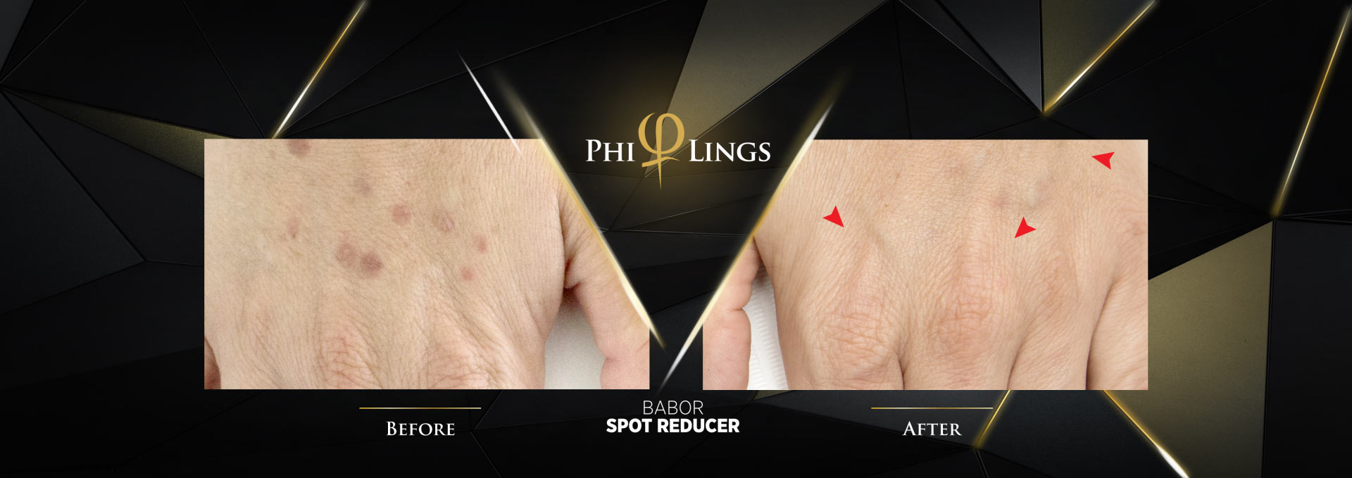 PHILINGS BABOR